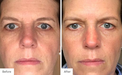 7 - Before and After Real Results image for Age IQ Night Cream